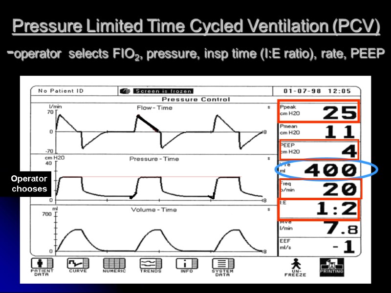 Pressure Limited Time Cycled Ventilation (PCV)  -operator selects FIO2, pressure, insp time (I:E